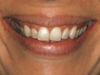 Konig Center for Cosmetic & Comprehensive Dentistry smile photos